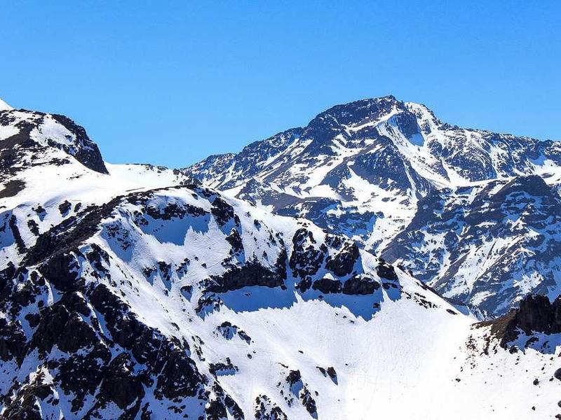 歯科医の優しい治療